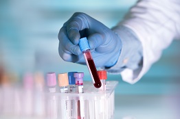 MEA clinical laboratory services market to top US$14 billion by 2023